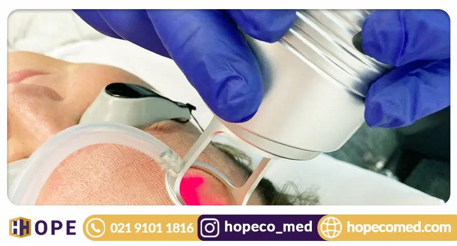 Fractional CO2 Laser Applications